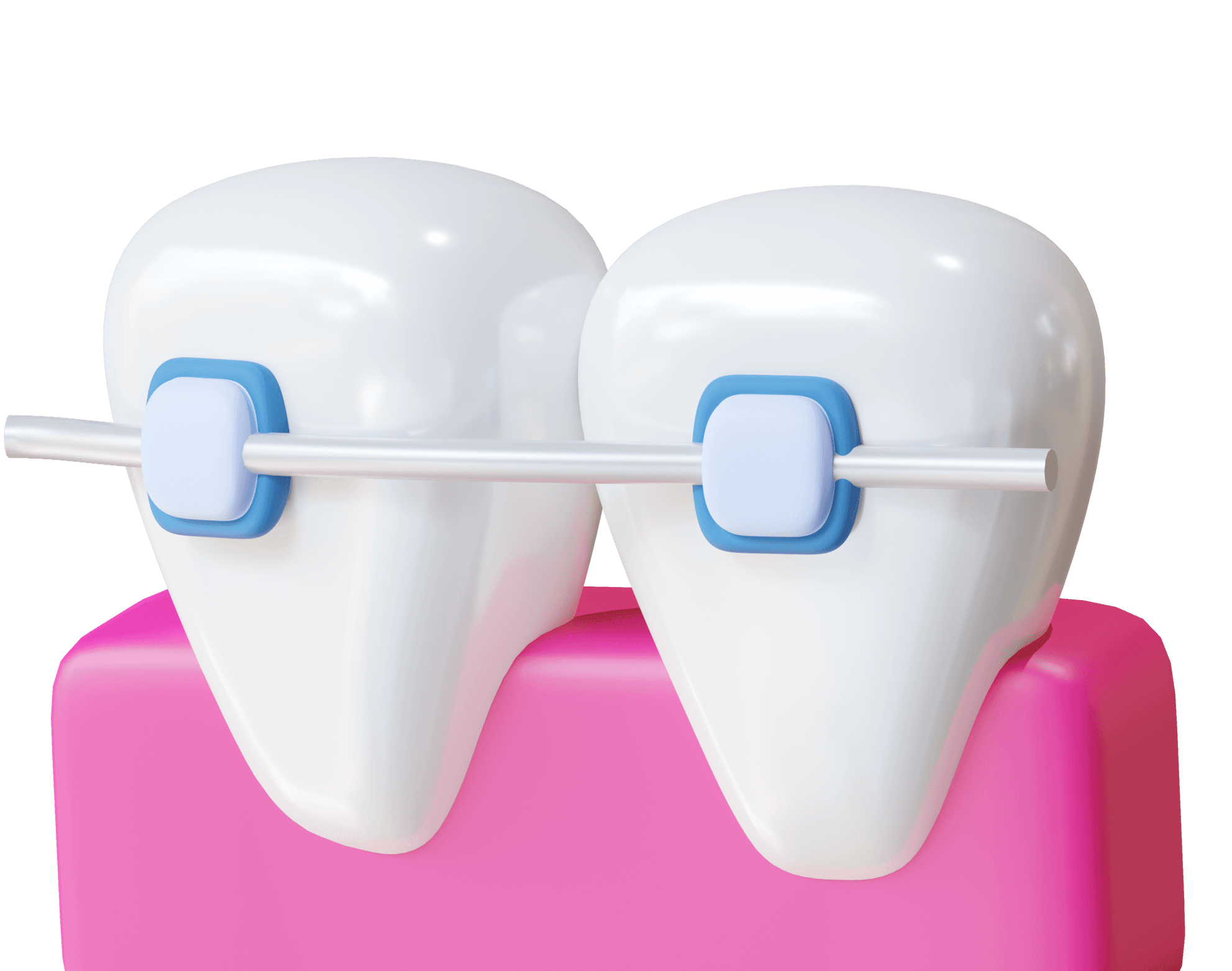 Cấy ghép implant & Phục hình